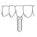 Dental implant icon