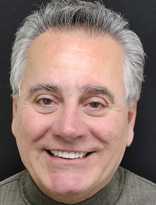 smile gallery headshot