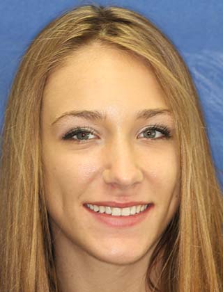 smile gallery headshot