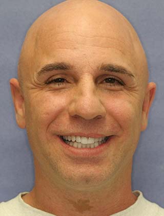 smile gallery headshot