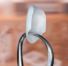 A porcelain veneer held in a pair of calipers