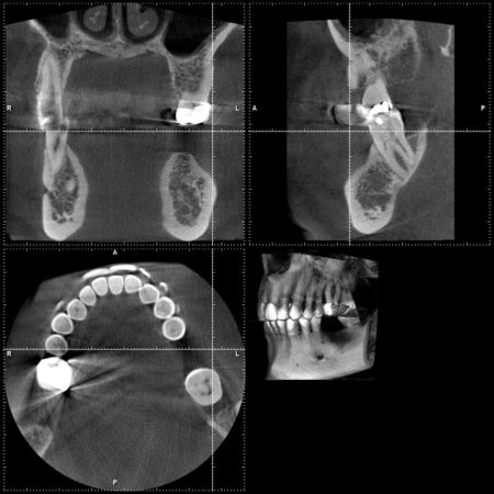 an image produced by a cone beam CT scanner