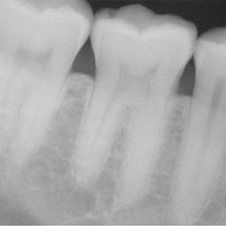 a digital x-ray