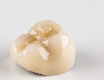A dental crown for a molar tooth