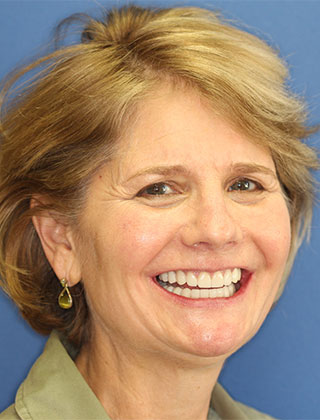 smile gallery headshot