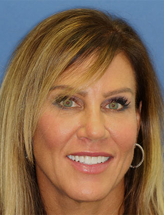 smile gallery headshot