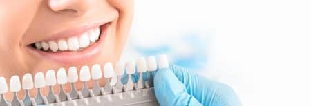 Close-up photo of a woman's smile as some options in shades of porcelain veneers are held up to her teeth for comparison.
